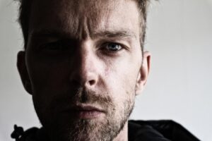 肘の黒ずみを改善するための評価の高いクリームは？